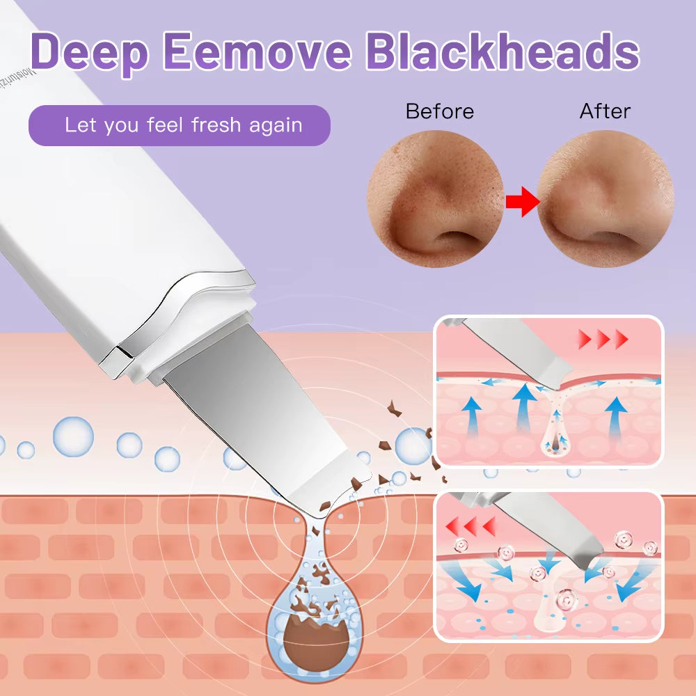 Electric Ultrasonic Skin Scrubber